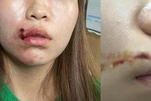 ‘대전판 돌려차기’ 가해자 적시 부부…“억울하다” 자진출석