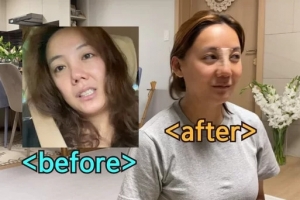 고은아 맞아? 코 재수술 후 얼굴…리즈시절