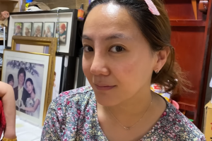 고은아, 재수술한 코 공개… “성형 중독” 발언엔 ‘발끈’