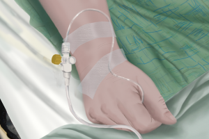 “잠들면 돌로 맞기”…1명 숨지고 1명은 의식불명