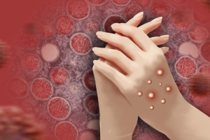 서울구치소 수용자 ‘수십명’ 집단 식중독 의심