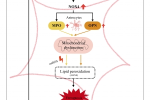 순천향대 연구팀, NOX4 유전자 활성화 ‘파킨슨병’ 유도