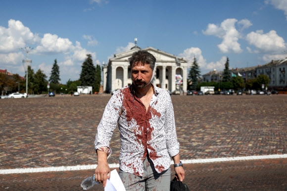러시아군의 미사일 공격에 크게 다친 남성이 19일(현지시간) 우크라이나 북부 체르히니우의 도심 광장에 있는 타라스 셰브첸코 체르히니우 지역 아카데미 음악 및 드라마 극장 근처에서 걸어나오고 있다. 체르히니우 AFP 연합뉴스