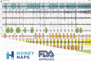 허니냅스 “AI 수면질환 진단 솔루션 ‘솜눔’ 美 FDA 승인”