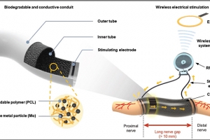 광범위 손상된 ‘말초신경’ 재생 촉진 전자약 개발