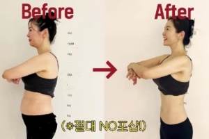장영란, 10일 만에 4㎏ 뺐다… 홀쭉해진 뱃살 눈길