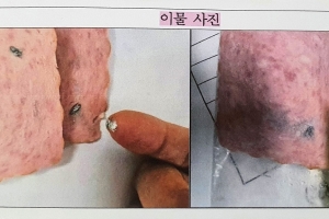 급식용 햄에서 나온 흰 가루, ‘돼지 지혈제’였다