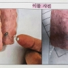 급식용 햄에서 나온 흰 가루, ‘돼지 지혈제’였다