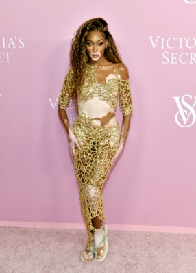 Winnie Harlow attends the Victoria‘s Secret “The Tour ’23” New York Fashion Week event on Wednesday, Sept. 6, 2023 in New York. AP 연합뉴스