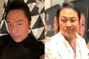 유명 배우 입 비뚤어졌다…‘건강 이상설’ 확산