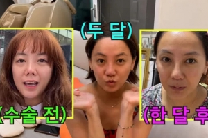 “뭔가 이상” “아바타 같다”…코 수술 인정한 女배우