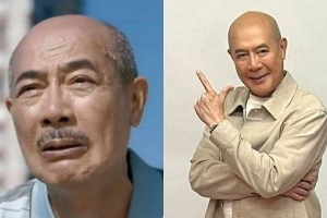 “30살은 젊어보여”…성형수술 완전 성공한 60대 배우