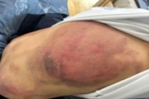 온몸 멍든 채 등교한 초등학생…“귀신에 씌어” 계모가 때려