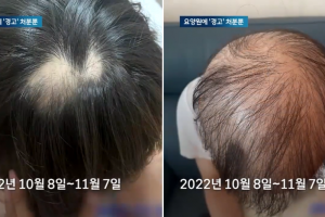 “머리털 다 빠졌는데” 20대 공익요원, 공무상 질병 인정은 못 받았다