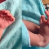 손가락 ‘14개’로 태어난 여자아이…부모가 기뻐한 이유