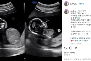 男배우와 결혼 하루만에 “임신” 소식 알린 女모델