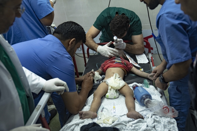 팔레스타인 의료진이 칸 유니스에서 이스라엘의 가자지구 폭격으로 부상당한 어린이를 치료하고 있다. (AP 사진/파티마 슈바이르)