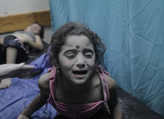 17일(현지시간) 이스라엘 폭격으로 부상을 입은 팔레스타인 어린이가 가자지구 칸 유니스의 병원에서 치료받고 있다. 2023.10.17 EPA 연합뉴스