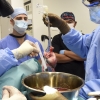 ‘돼지 심장’ 이식받은 두 번째 환자, 6주 생존…결국 사망