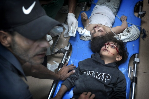 팔레스타인 어린이들이 지난 15일(현지시간) 가자지구 중부 데이르 알발라에 있는 한 병원에서 이스라엘 공습에 다친 부위를 치료받고 있다. AP 자료사진 연합뉴스