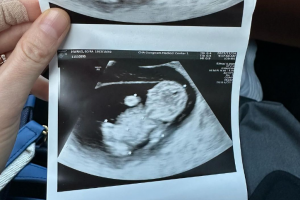 시험관 4차 끝 임신한 황보라…‘김용건 손자·하정우 조카’ 생긴다