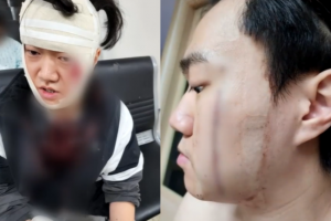 “살려주세요” 외침에 달려간 父子…50바늘 꿰맨 아들 “피해자 무사해 다행”