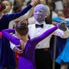 러 공습 안면화상 여덟 살 소년… 치료 마스크 쓰고 ‘희망의 댄스’