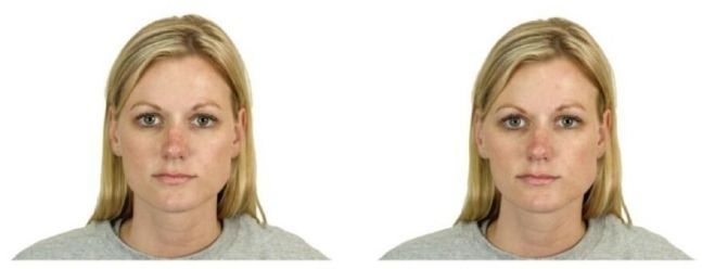 실험에 사용된 자연스러운 얼굴(왼쪽)과 비대칭으로 조작된 얼굴. Journal of Psychopharmacology/Alistair J Harvey et al
