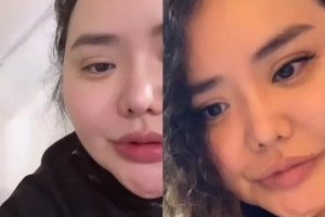 홍진영 언니 맞아? 몰라보게 예뻐진 근황