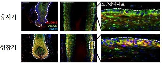 휴지기 모낭과 성장기 모낭에서 ALDH2 발현 비교. 면역염색 분석 결과, 주로 모낭의 가장 바깥쪽 층(모낭상피세포층)에서 성장기에 ALDH2가 뚜렷하게 나타났다. 서울대병원 제공