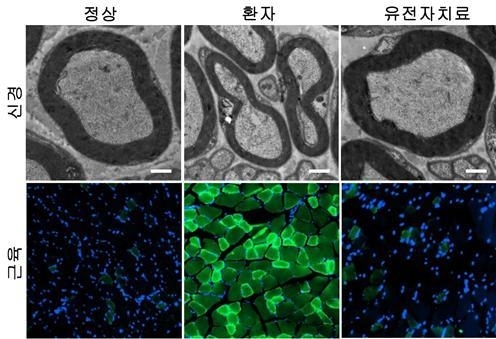 샤르코 마리 투스병 2Z(CMT2Z) 시료에 유전자 치료제를 적용한 모습. 염수청 서울대학교 국제농업기술대학원 교수와 최병옥 삼성서울병원 신경과 교수의 공동 연구팀 제공