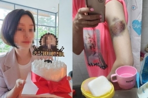 ‘스토킹 살해’ 목격한 6세 딸…처음으로 꺼낸 말은