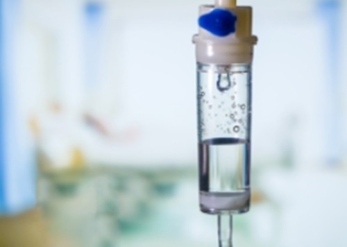 링거. 서울신문DB