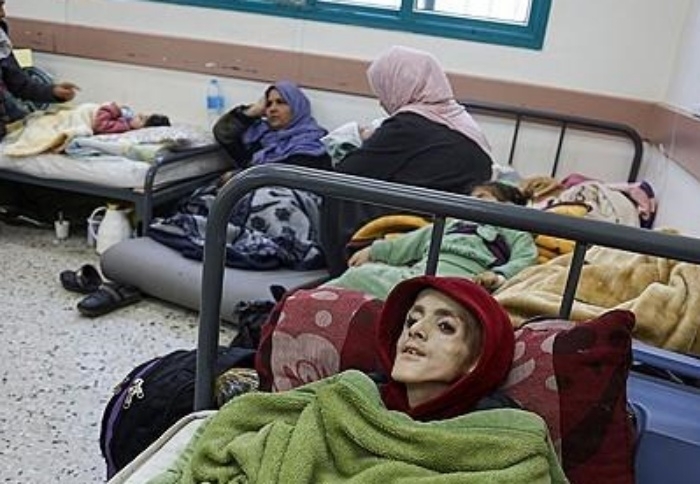 영양실조로 사망한 가자지구 소년 야잔 카파르네. AFP 연합뉴스