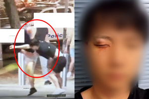 韓남성, 백인들에 ‘집단폭행’ 당해 응급실…바로 앞은 경찰서였다