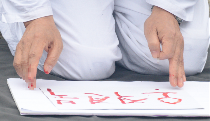 정운천 국민의힘 전북 전주시을 선거구 국회의원 후보가 4일 전북 전주시 전북특별자치도청 앞 광장에서 기자회견을 열고 혈서를 쓰고 있다. 2024.04.04. 뉴시스