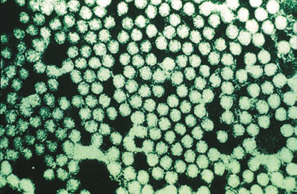 구제역을 일으키는 구제역 바이러스를 전자 현미경으로 찍은 사진  위키피디아 제공