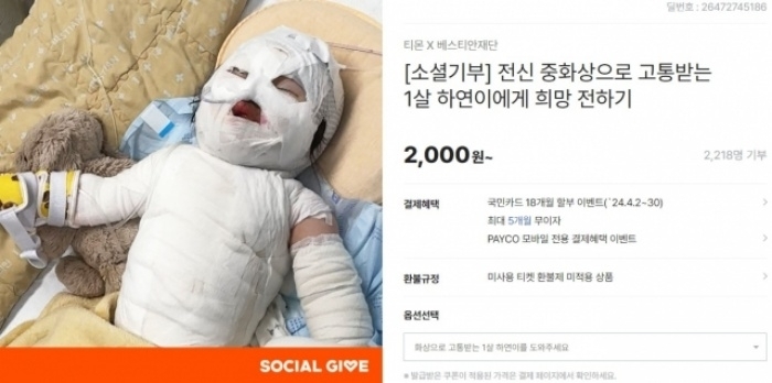 전신 중화상을 입은 1살 하연이(가명)를 후원하기 위한 캠페인이 진행 중이다.  티몬 홈페이지 캡처