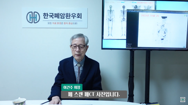 이건주 한국폐암환우회 회장이 지난 2월 자신의 폐 CT 사진을 공개하며 의료공백 사태 해결을 호소했다. 한국폐암환우회 유튜브 ‘폐암 환우 TV’ 캡처