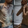 “러시아에 잡혀갔다 뼈만 남아…나치 연상” 우크라이나 포로 충격적인 사진 공개