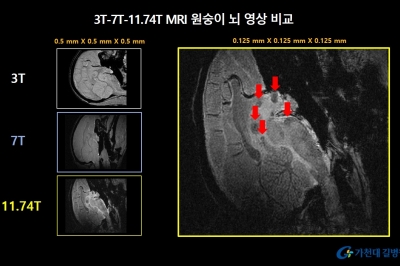 가천대 길병원 “세계 최초 원숭이 뇌 영상 획득”