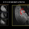 가천대 길병원 “세계 최초 원숭이 뇌 영상 획득”