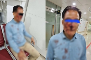 “코뼈 부러지고 얼굴 피범벅” 승객의 폭행…피투성이 된 택시기사