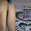 thumbnail - “딸 죽었는데…가해자 인생 생각하라던 경찰” 교제폭력 유족의 청원