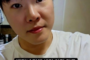 휘성, 퉁퉁 부은 얼굴에 성형·건강이상설?…측근 “살찐 것”