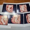 다섯쌍둥이 경사에 “적극 지원할 것”…부부가 받는 금액, 얼마길래
