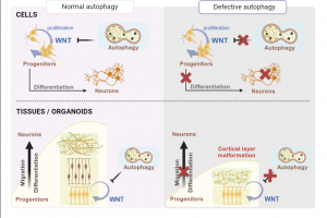순천향대 심재원 교수팀, ‘뇌신경 발생 질환’ 발병 기전 규명