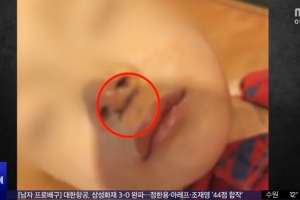 thumbnail - 얼굴 찢어진 2살…“놀다가 다쳤다”던 교사, CCTV 확인한 부모 ‘경악’