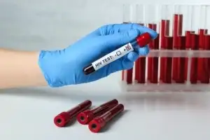 에이즈 걸린 40대, 알면서도 여중생 성매매…“약 먹고 콘돔 착용했다”