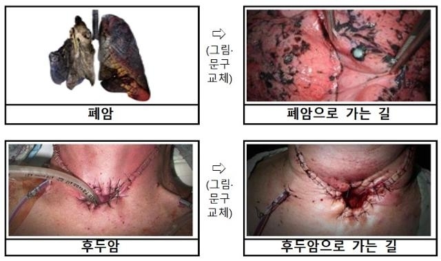 23일부터 새로 적용되는 담뱃갑 경고 그림. 보건복지부 제공